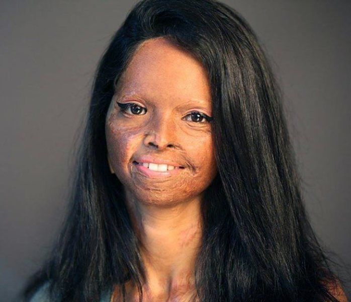 Laxmi Agarwal Indian acid attack survivor Wiki ,Bio, Profile, Unknown Facts and Family Details revealed